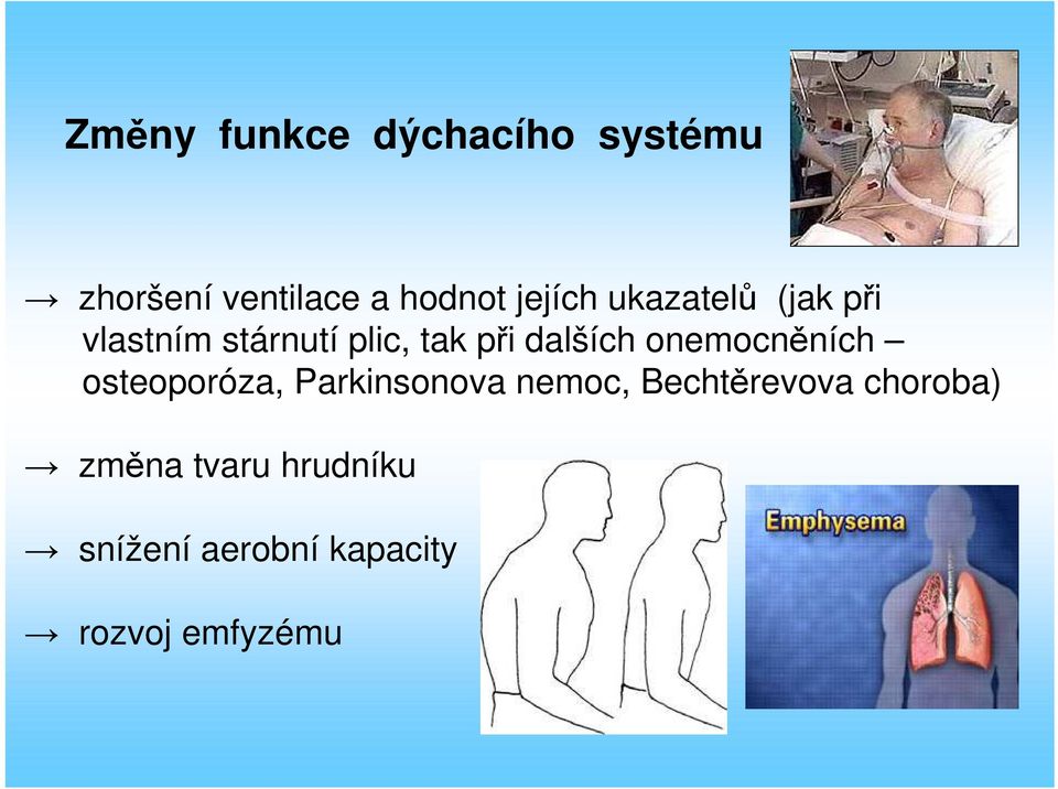 dalších onemocněních osteoporóza, Parkinsonova nemoc,