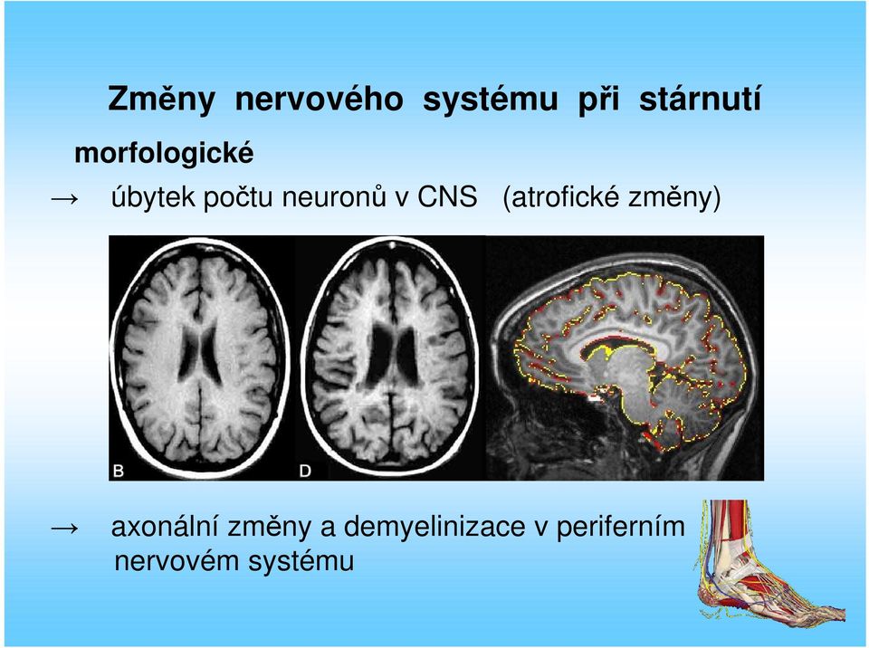 CNS (atrofické změny) axonální změny a