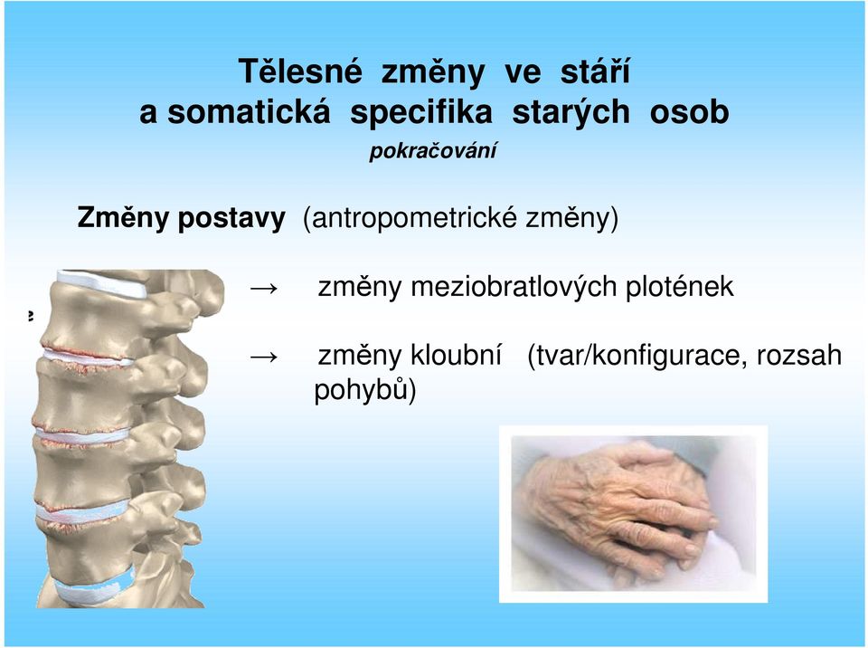 (antropometrické změny) změny meziobratlových