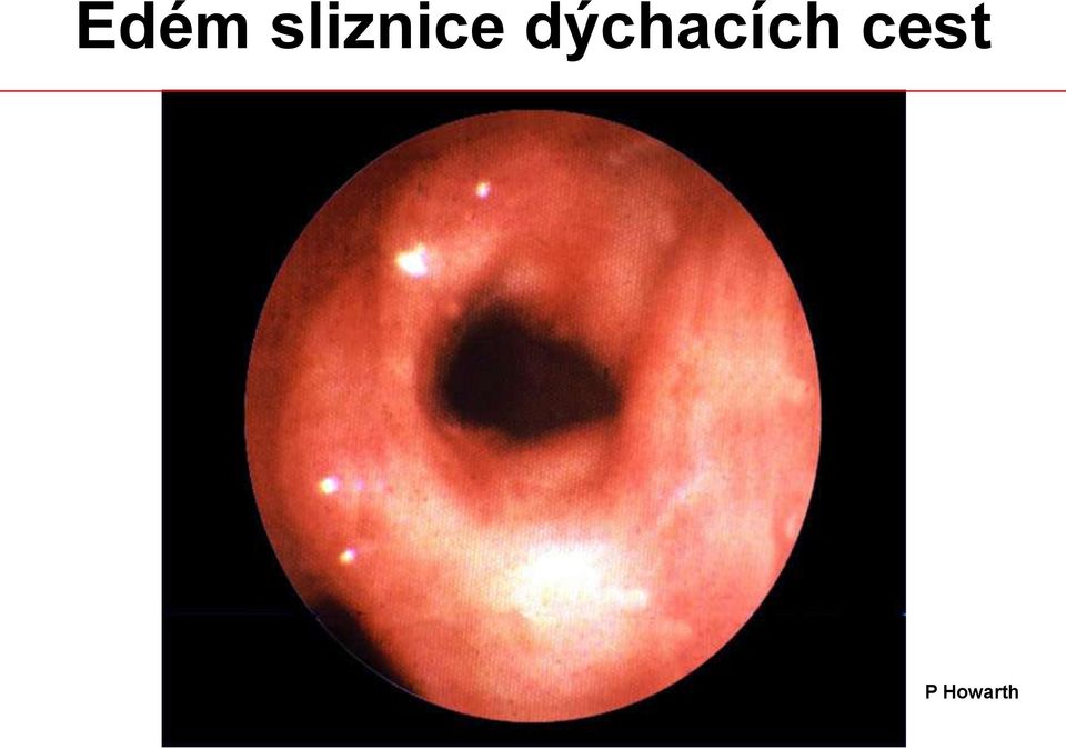 dýchacích