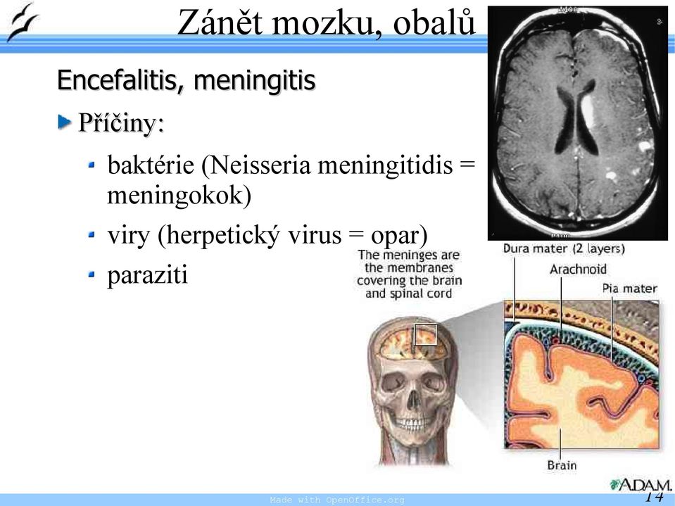 meningitidis = meningokok) viry