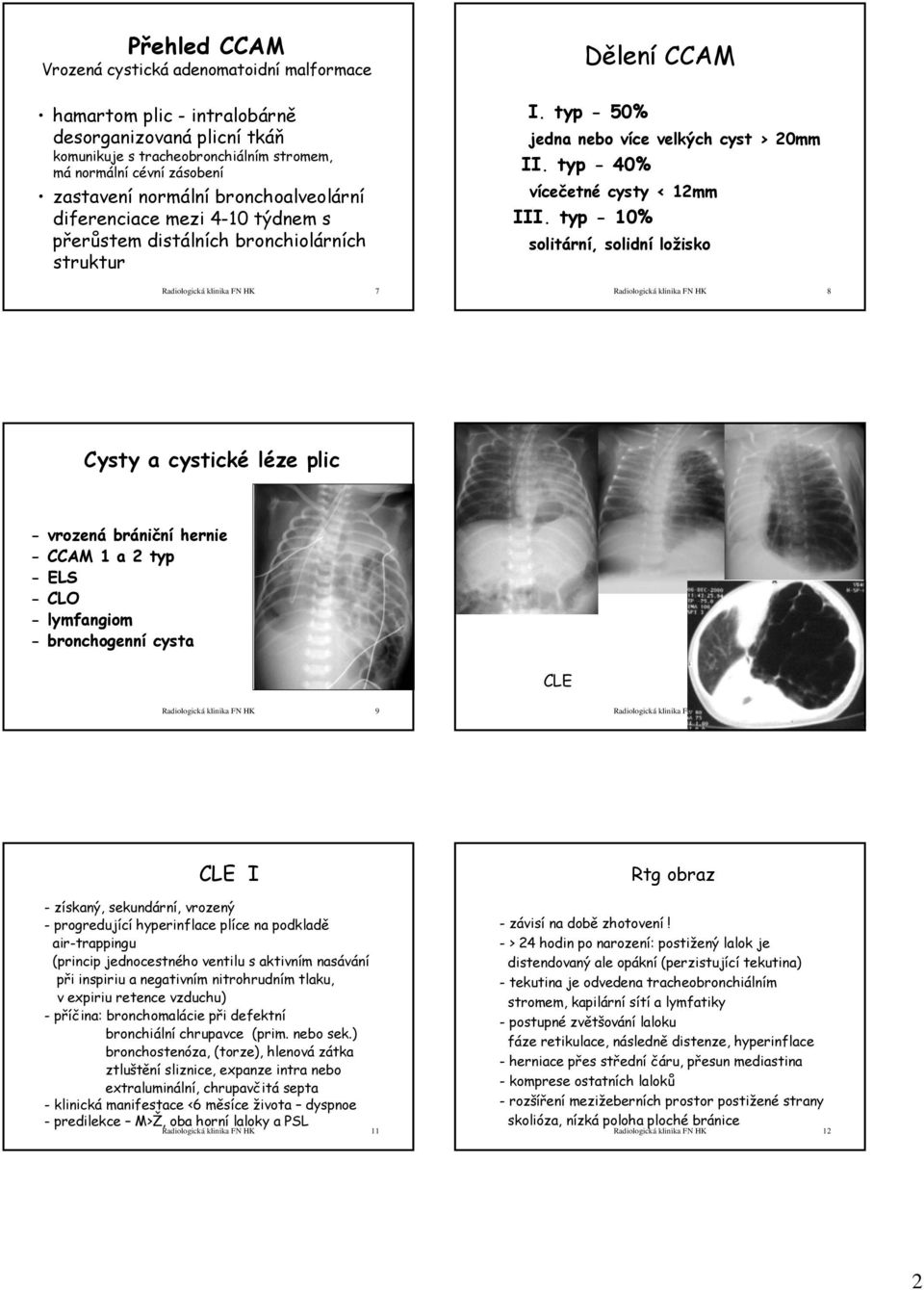 typ - 40% vícečetné cysty < 12mm III.