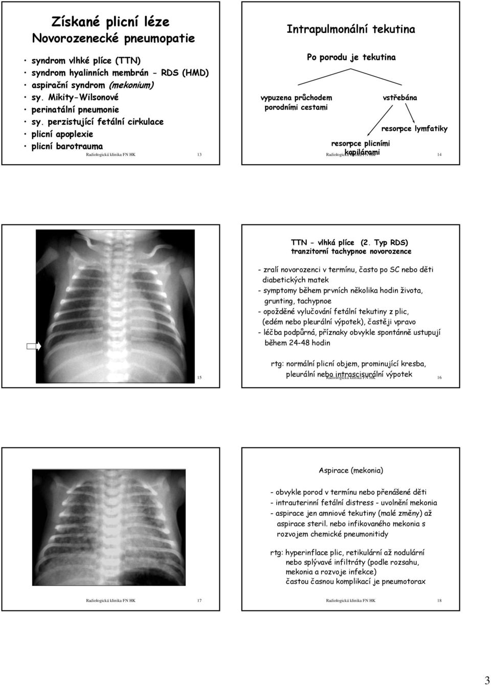 kapilárami vstřebána resorpce lymfatiky Radiologická klinika FN HK 14 TTN - vlhká plíce (2.