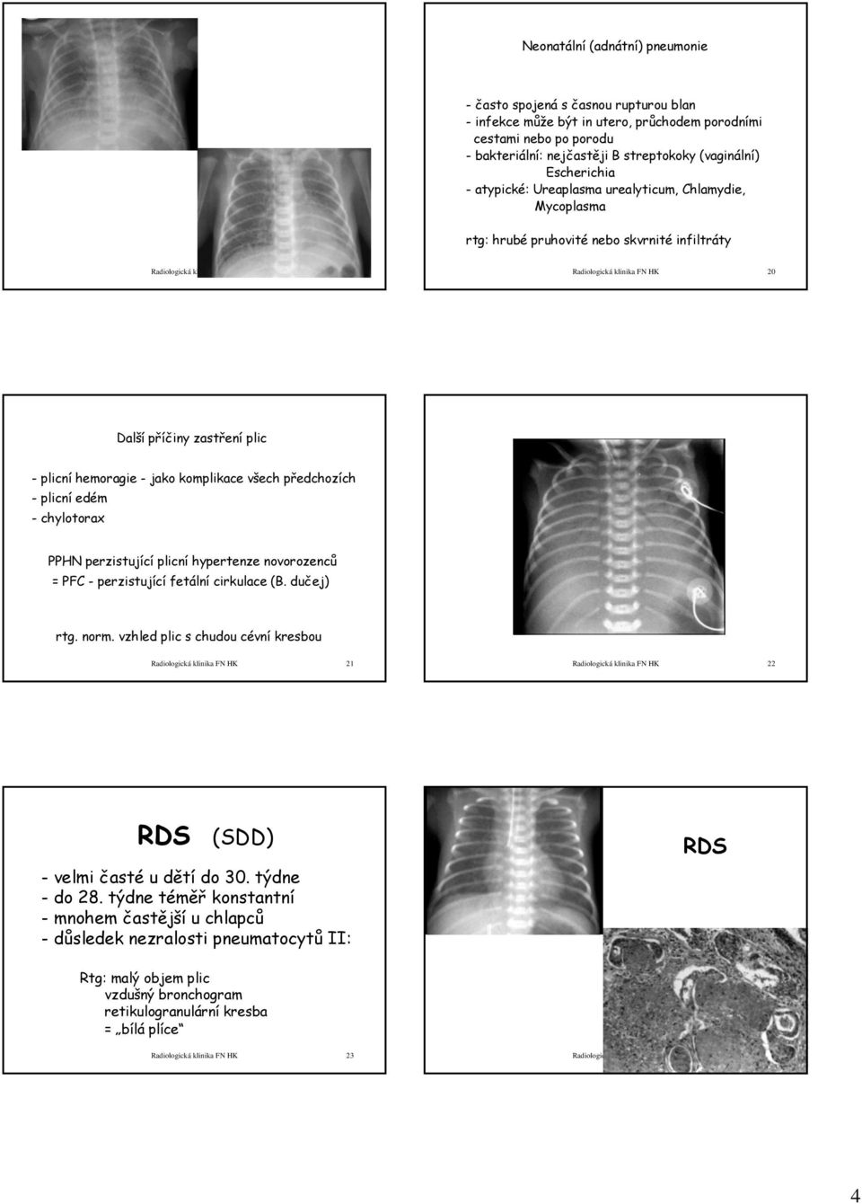 plic - plicní hemoragie - jako komplikace všech předchozích -plicníedém - chylotorax PPHN perzistující plicní hypertenze novorozenců = PFC - perzistující fetální cirkulace (B. dučej) rtg. norm.