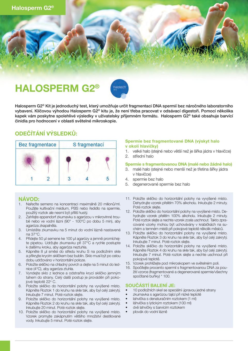 Halosperm G2 také obsahuje barvící činidla pro hodnocení v oblasti světelné mikroskopie. ODEČÍTÁNÍ VÝSLEDKŮ: Spermie bez fragmentované DNA (výskyt halo v okolí hlavičky) 1.