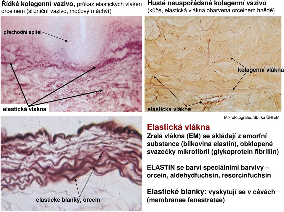 Zralá vlákna (EM) se skládají z amorfní substance (bílkovina elastin), obklopené svazečky mikrofibril (glykoprotein fibrillin) ELASTIN se barví