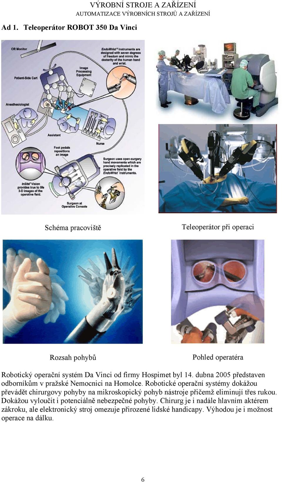 Robotické operační systémy dokážou převádět chirurgovy pohyby na mikroskopický pohyb nástroje přičemž eliminují třes rukou.