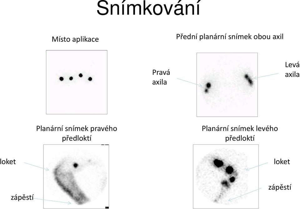 Planární snímek pravého předloktí Planární