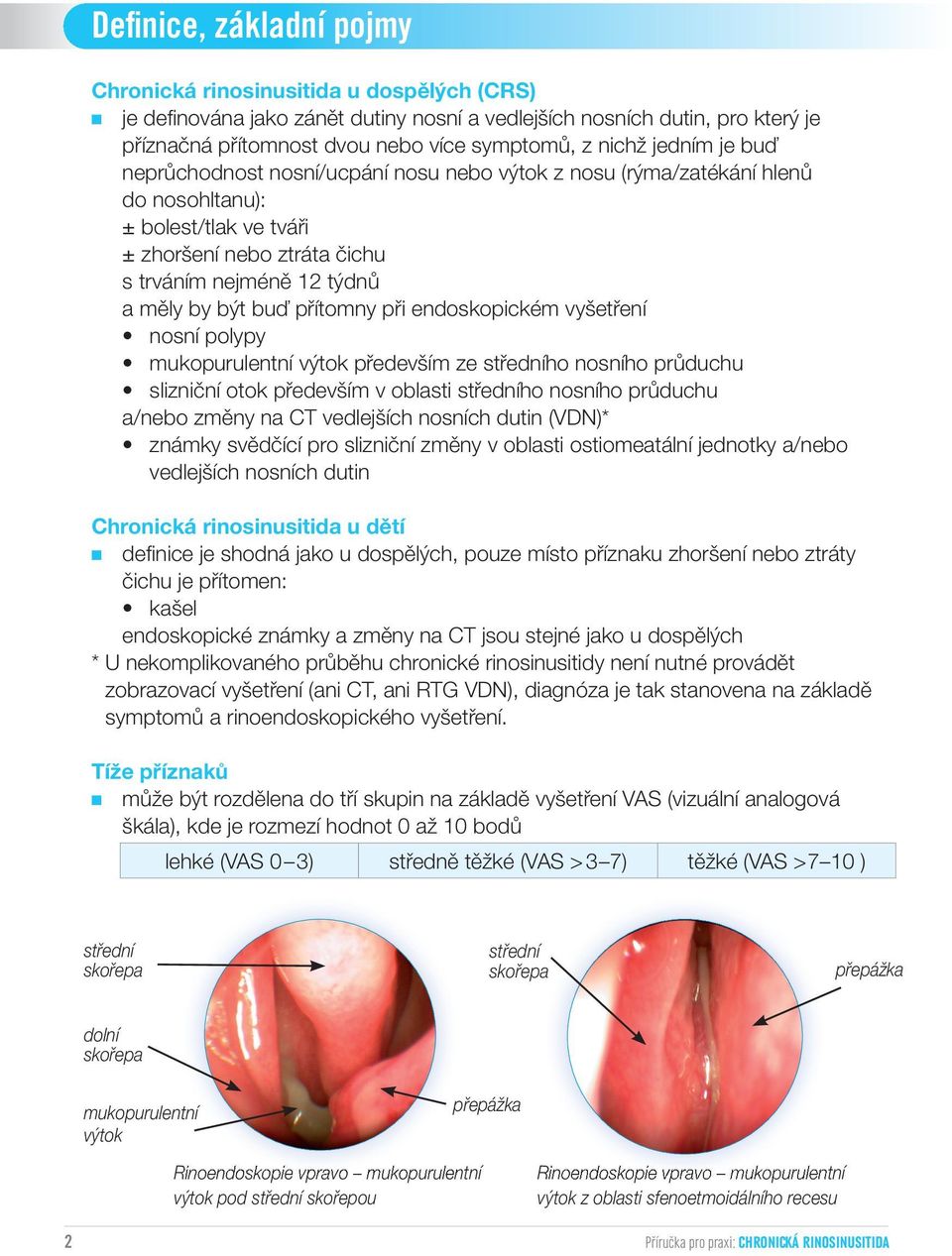 buď přítomny při endoskopickém vyšetření nosní polypy mukopurulentní výtok především ze středního nosního průduchu slizniční otok především v oblasti středního nosního průduchu a/nebo změny na CT