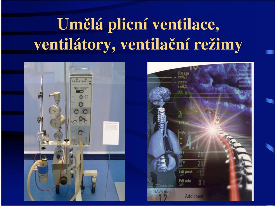 Um lá plicní ventilace, ventilátory, ventila ní režimy - PDF Free Download