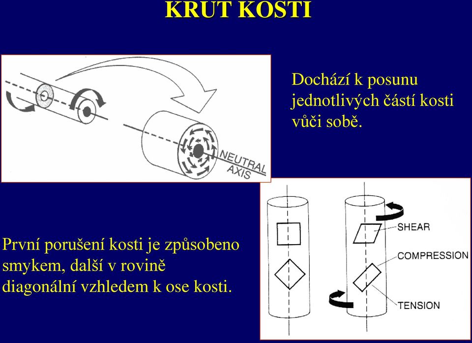 První porušení kosti je způsobeno