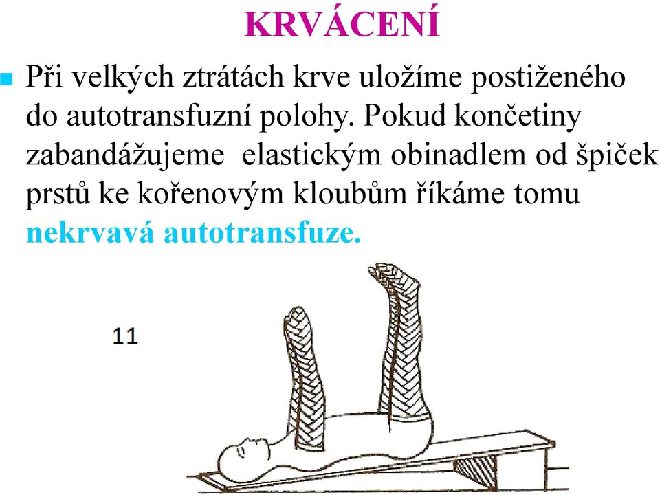 Pokud končetiny zabandážujeme elastickým obinadlem