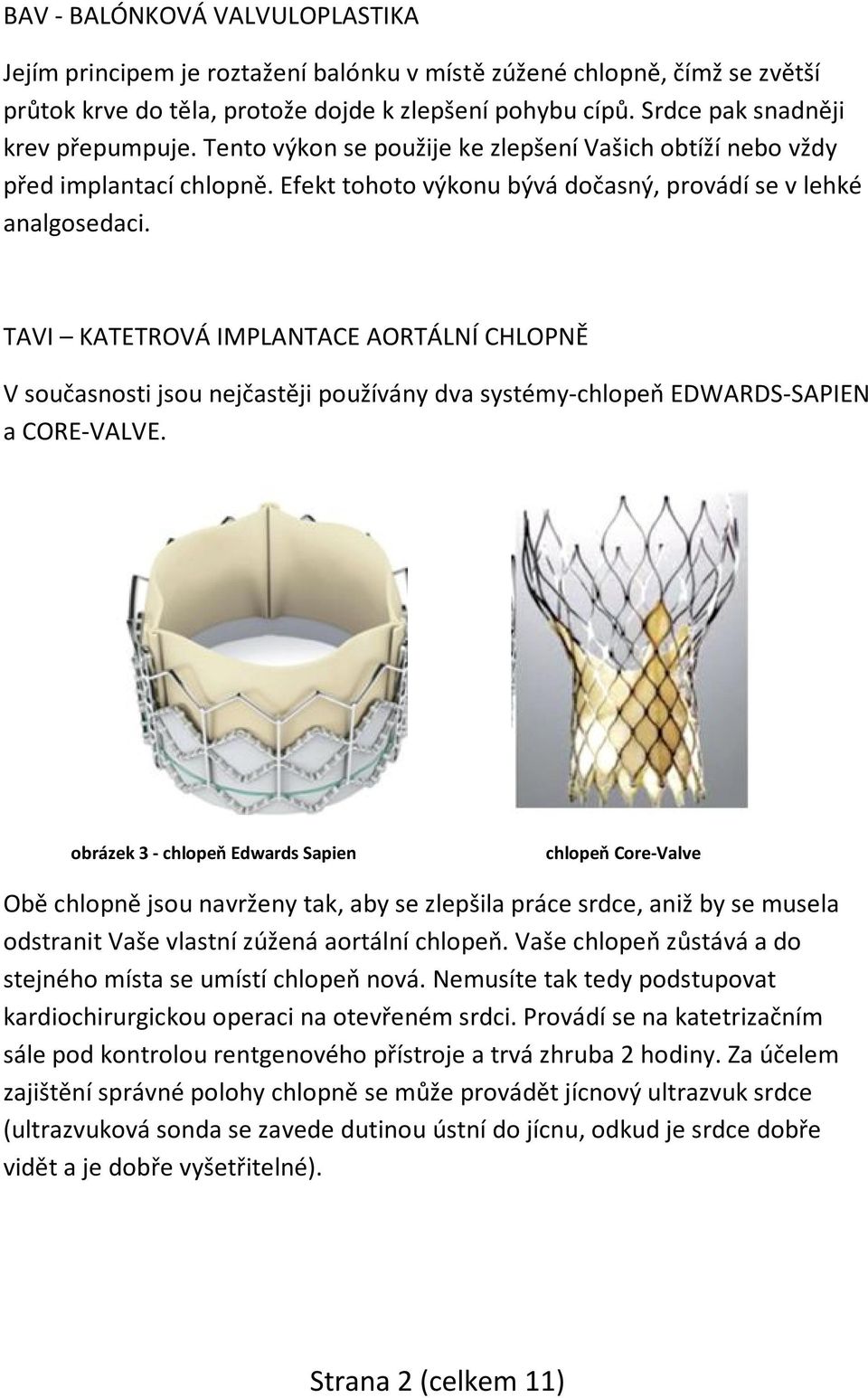 TAVI KATETROVÁ IMPLANTACE AORTÁLNÍ CHLOPNĚ V současnosti jsou nejčastěji používány dva systémy-chlopeň EDWARDS-SAPIEN a CORE-VALVE.