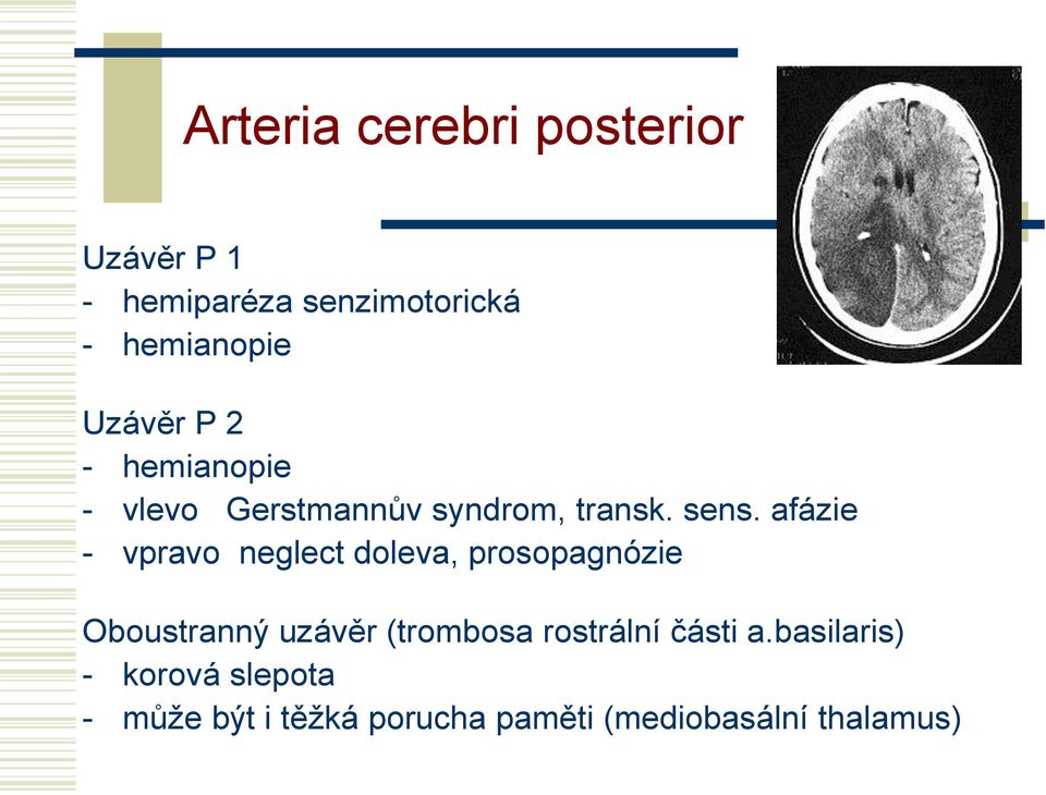 afázie - vpravo neglect doleva, prosopagnózie Oboustranný uzávěr (trombosa