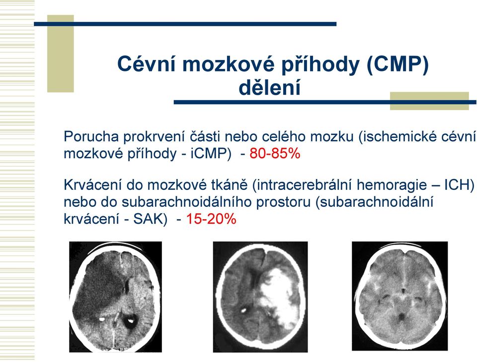 Krvácení do mozkové tkáně (intracerebrální hemoragie ICH) nebo do