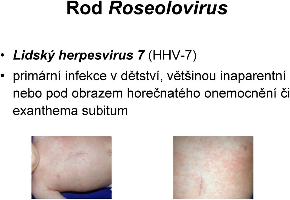 většinou inaparentní nebo pod obrazem