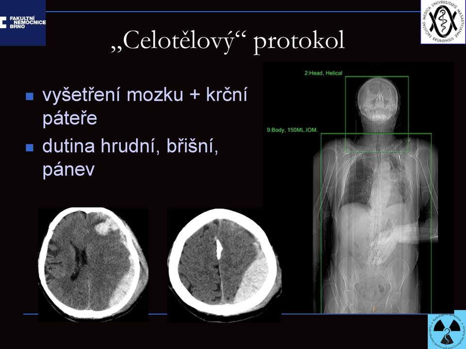 krční páteře dutina