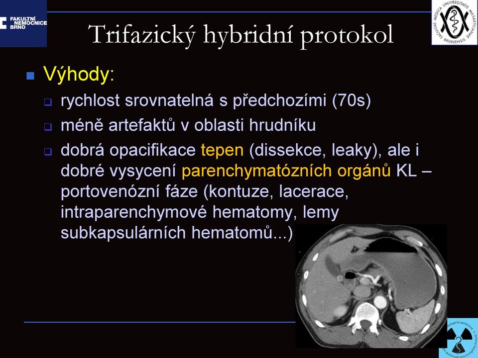 leaky), ale i dobré vysycení parenchymatózních orgánů KL portovenózní fáze