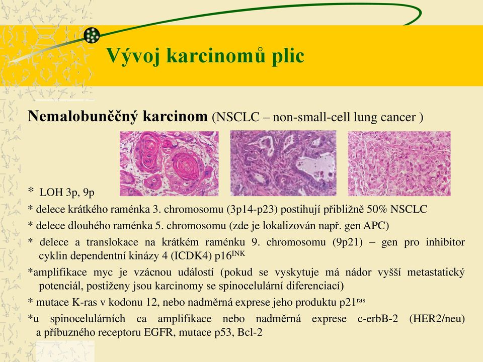 chromosomu (9p21) gen pro inhibitor cyklin dependentní kinázy 4 (ICDK4) p16 INK *amplifikace myc je vzácnou událostí (pokud se vyskytuje má nádor vyšší metastatický potenciál,