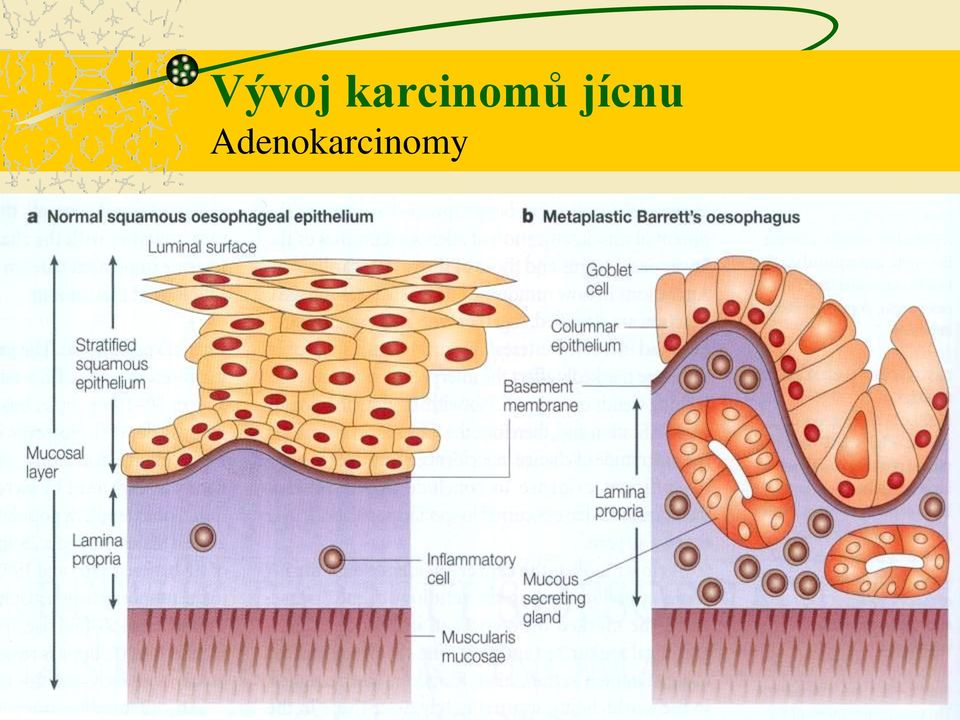 jícnu