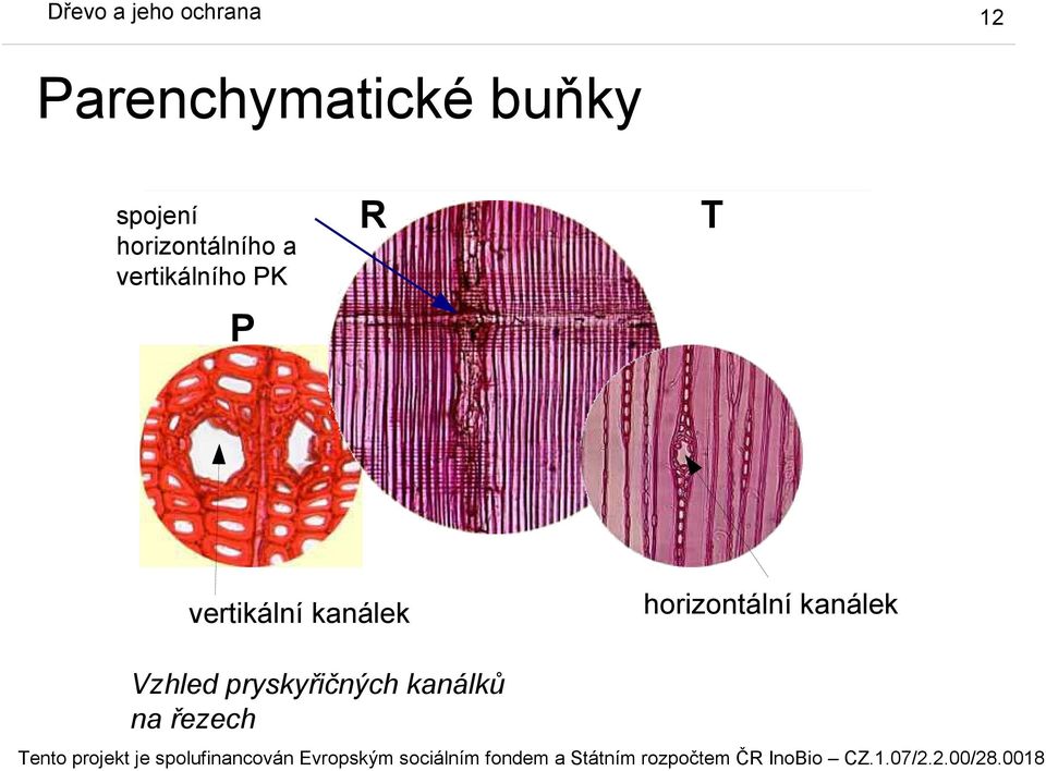 P vertikální kanálek horizontální