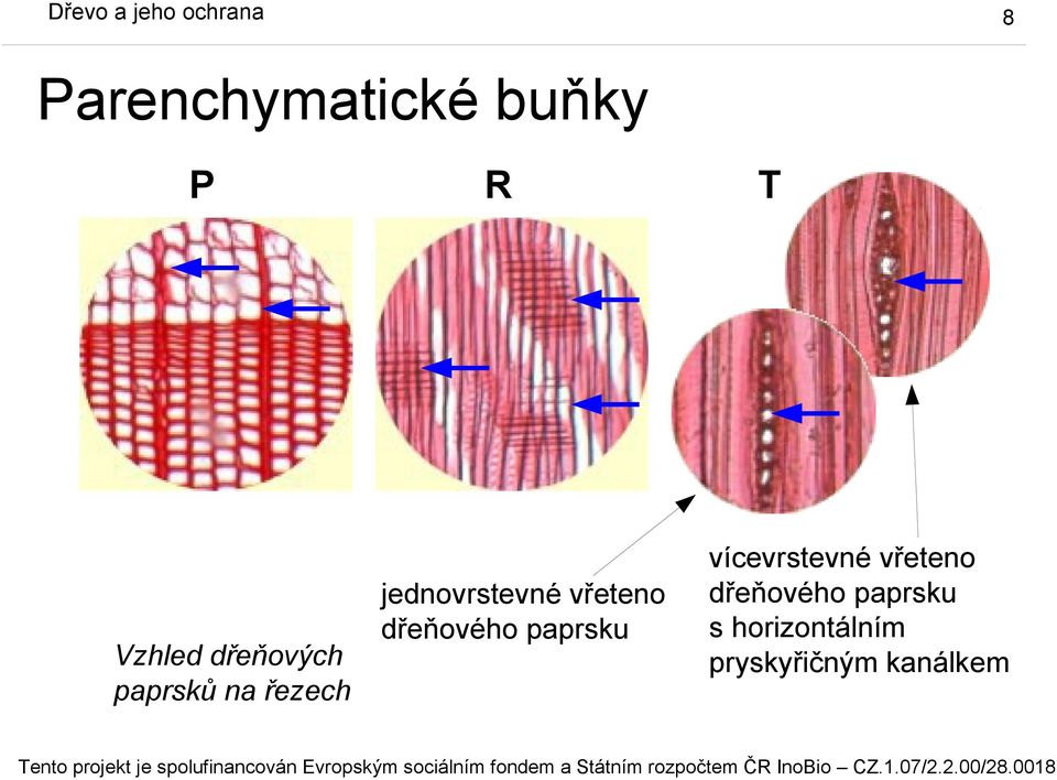 dřeňového paprsku T vícevrstevné vřeteno