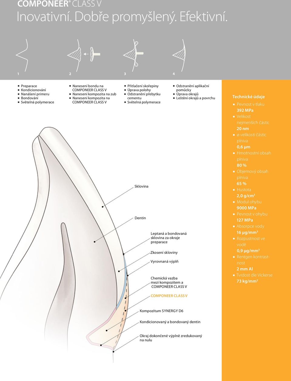 přebytku cementu Světelná polymerace Odstranění aplikační pomůcky Úprava okrajů Leštění okrajů a povrchu Sklovina Dentin Leptaná a bondovaná sklovina za okraje preparace Zkosení skloviny Vyrovnaná