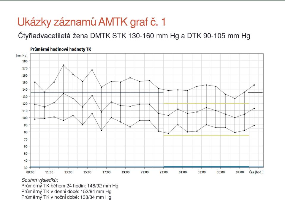 90-105 mm Hg Souhrn výsledků: Průměrny TK během 24 hodin: