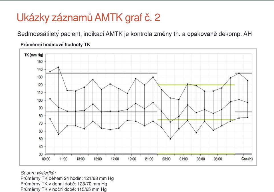 a opakovaně dekomp.