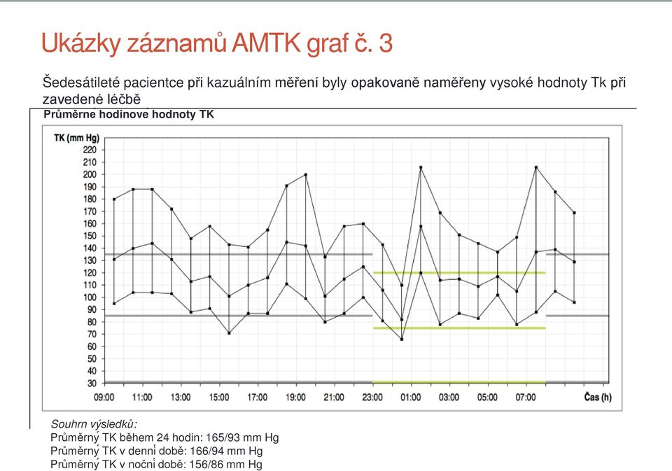 vysoké hodnoty Tk při zavedené léčbě Průměrne hodinove hodnoty TK Souhrn