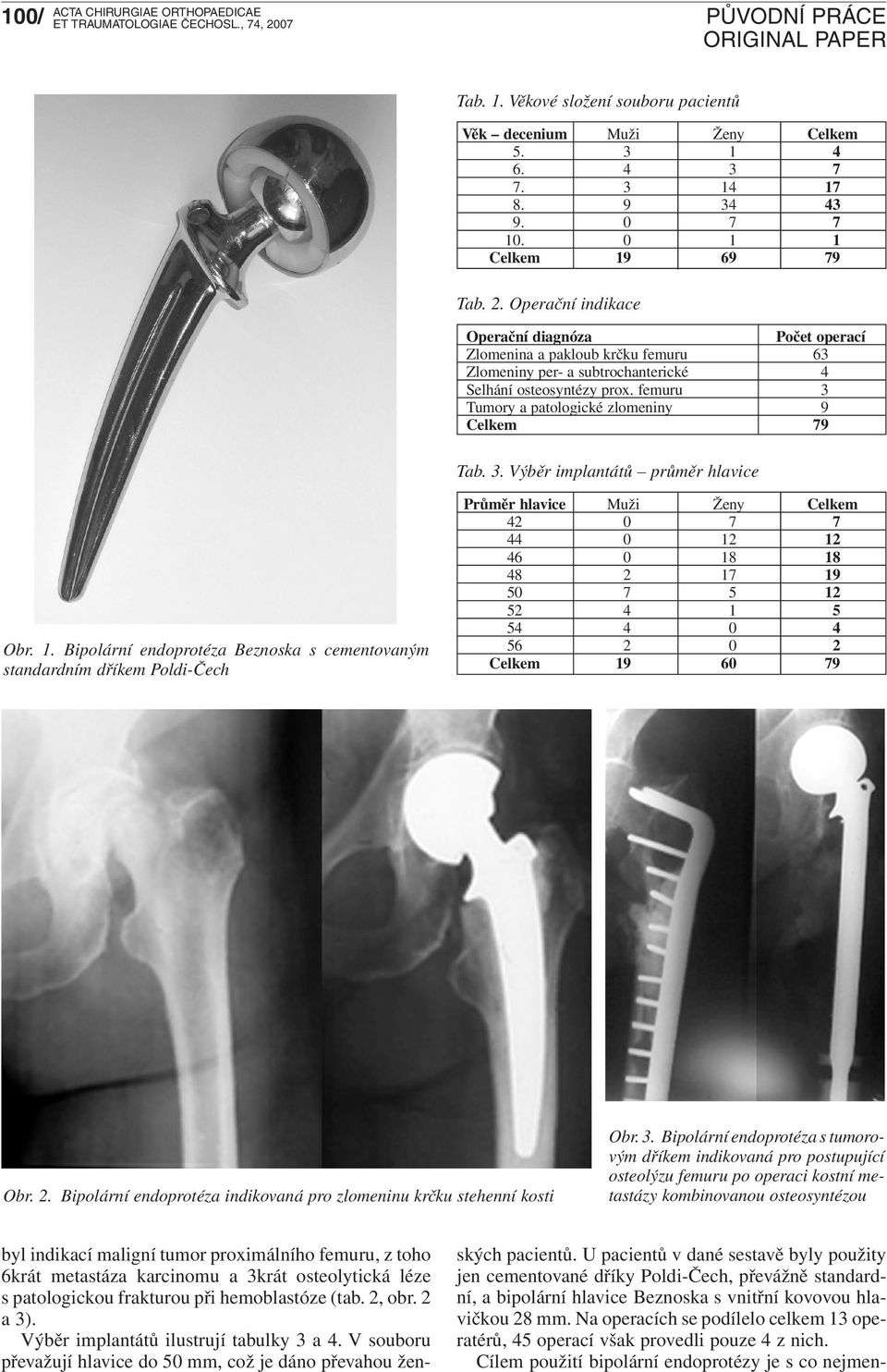 femuru 3 Tumory a patologické zlomeniny 9 Celkem 79 Tab. 3. Výběr implantátů průměr hlavice Obr. 1.