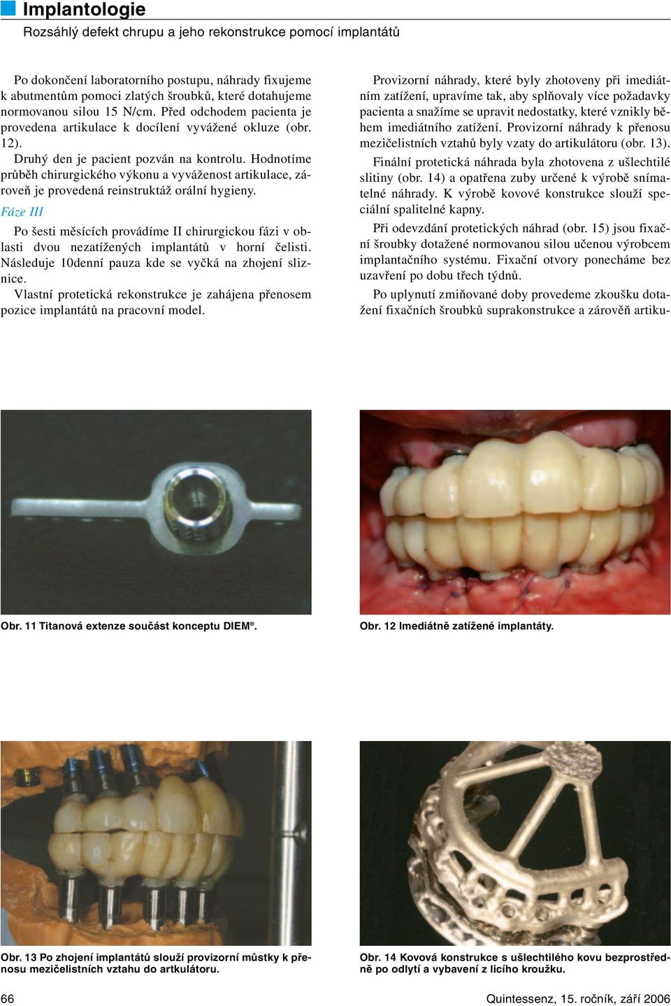 Hodnotíme průběh chirurgického výkonu a vyváženost artikulace, zároveň je provedená reinstruktáž orální hygieny.