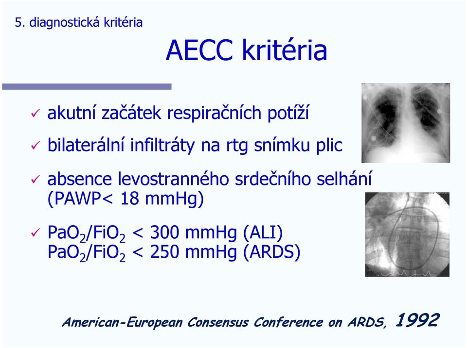 levostranného srdečního selhání (PAWP< 18 mmhg) PaO2/FiO2 < 300 mmhg