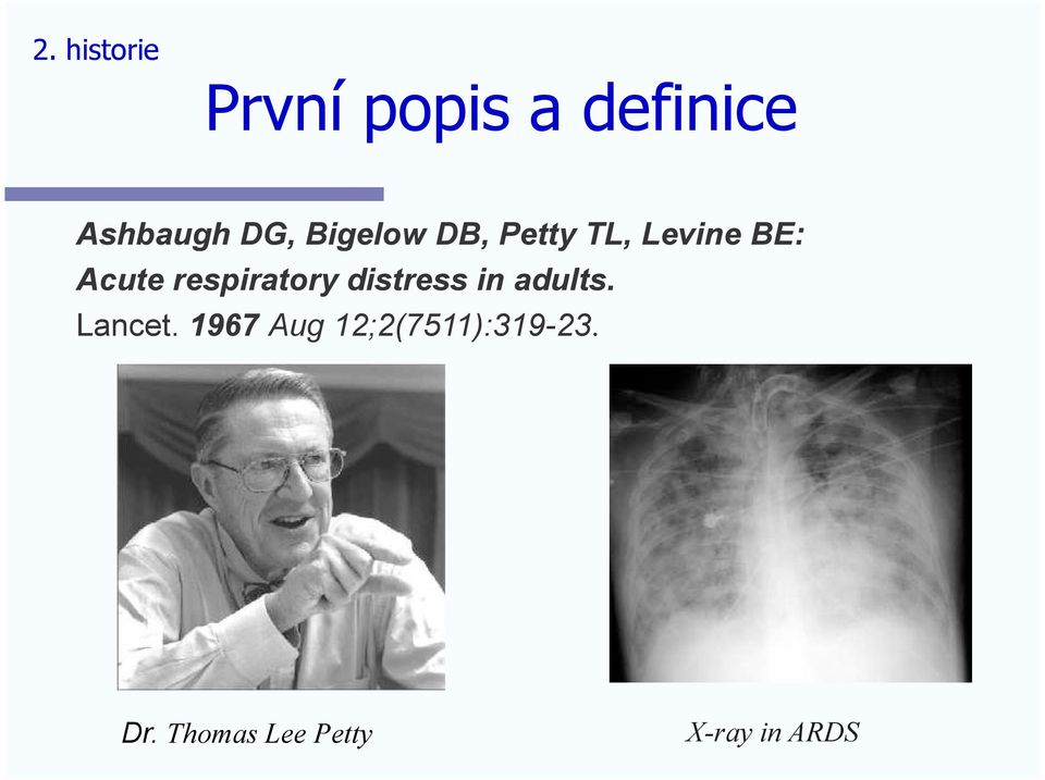 respiratory distress in adults. Lancet.