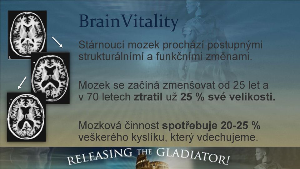 Mozek se začíná zmenšovat od 25 let a v 70 letech