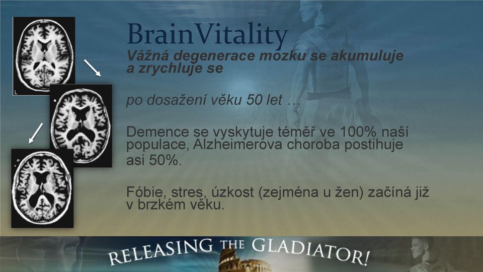 naší populace, Alzheimerova choroba postihuje asi 50%.