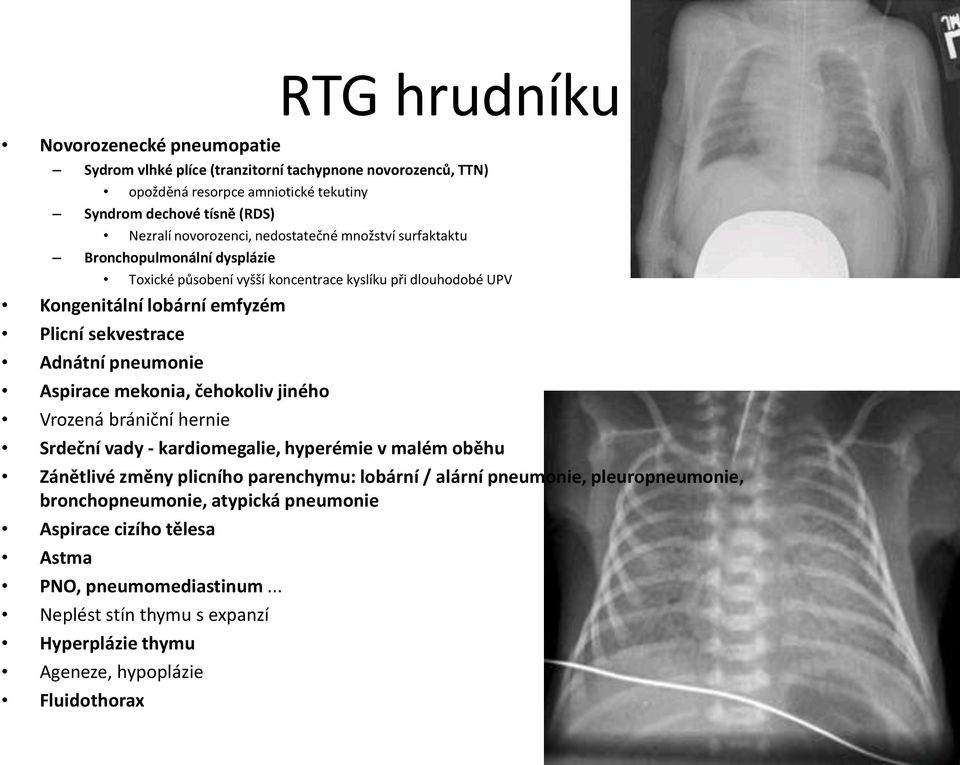 Adnátní pneumonie Aspirace mekonia, čehokoliv jiného Vrozená brániční hernie Srdeční vady - kardiomegalie, hyperémie v malém oběhu Zánětlivé změny plicního parenchymu: lobární / alární