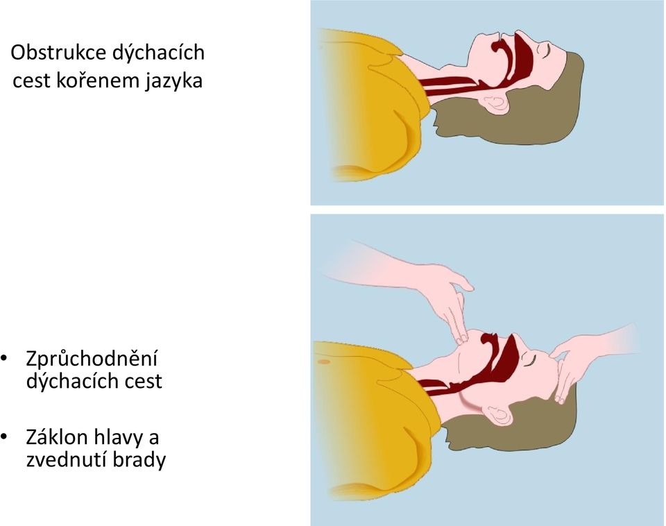 Zprůchodnění dýchacích