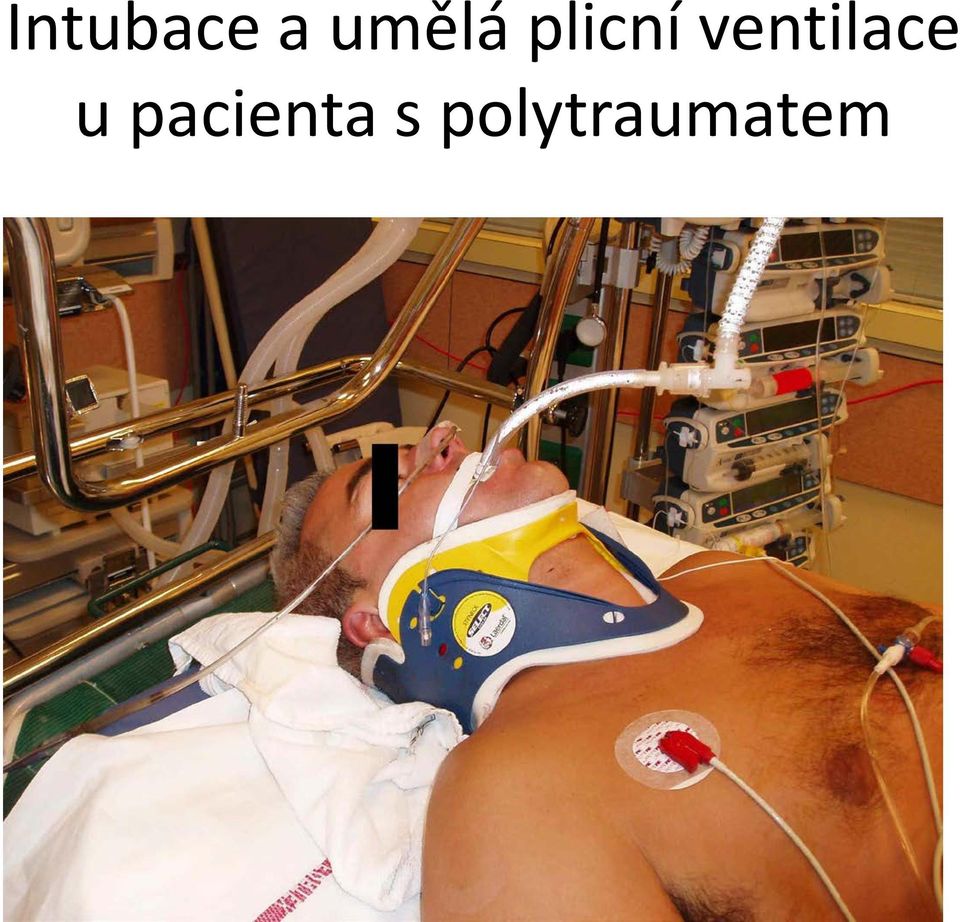 ventilace u