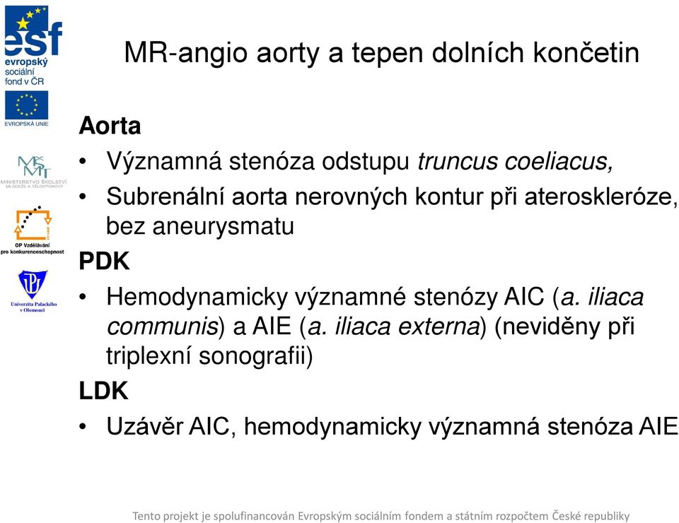 PDK Hemodynamicky významné stenózy AIC (a. iliaca communis) a AIE (a.