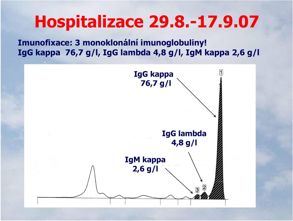 07 Imunofixace: 3 monoklonální imunoglobuliny!