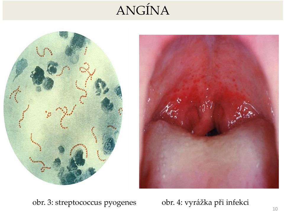 pyogenes obr.