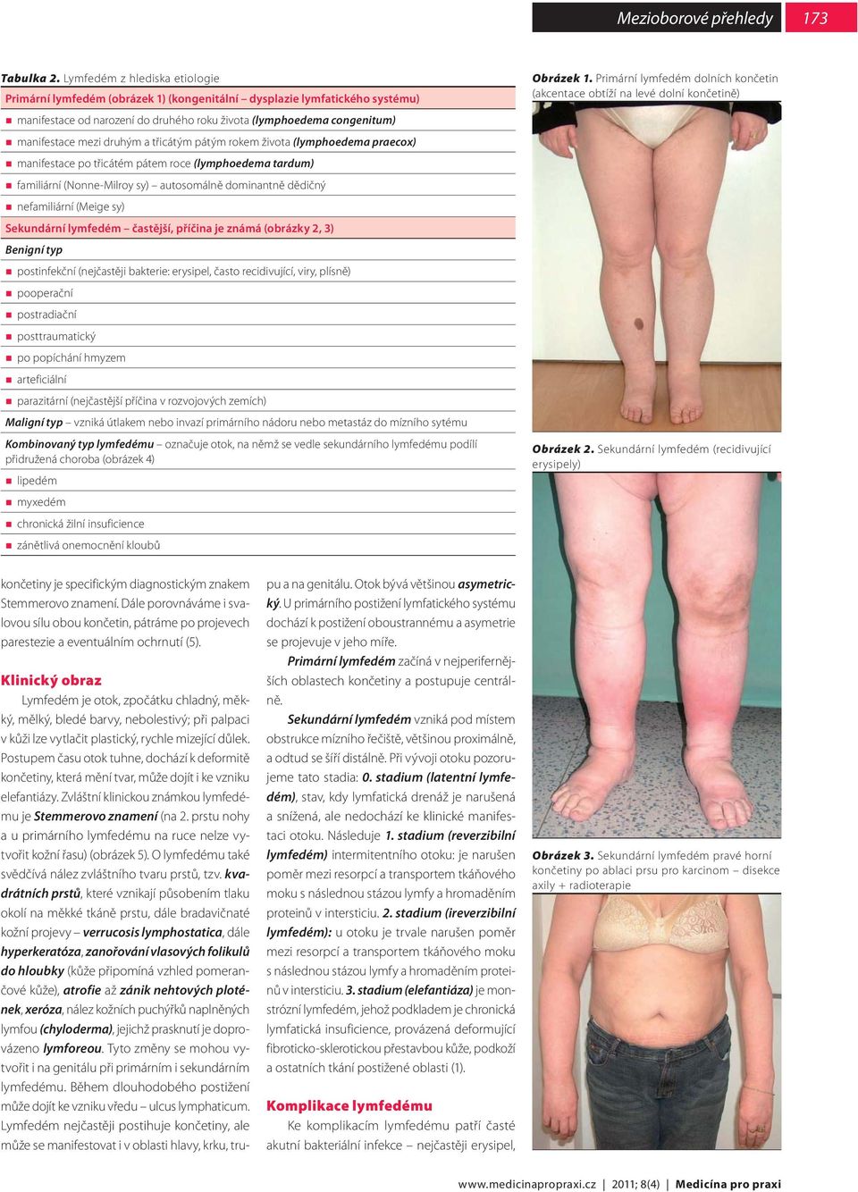 druhým a třicátým pátým rokem života (lymphoedema praecox) manifestace po třicátém pátem roce (lymphoedema tardum) familiární (Nonne-Milroy sy) autosomálně dominantně dědičný nefamiliární (Meige sy)