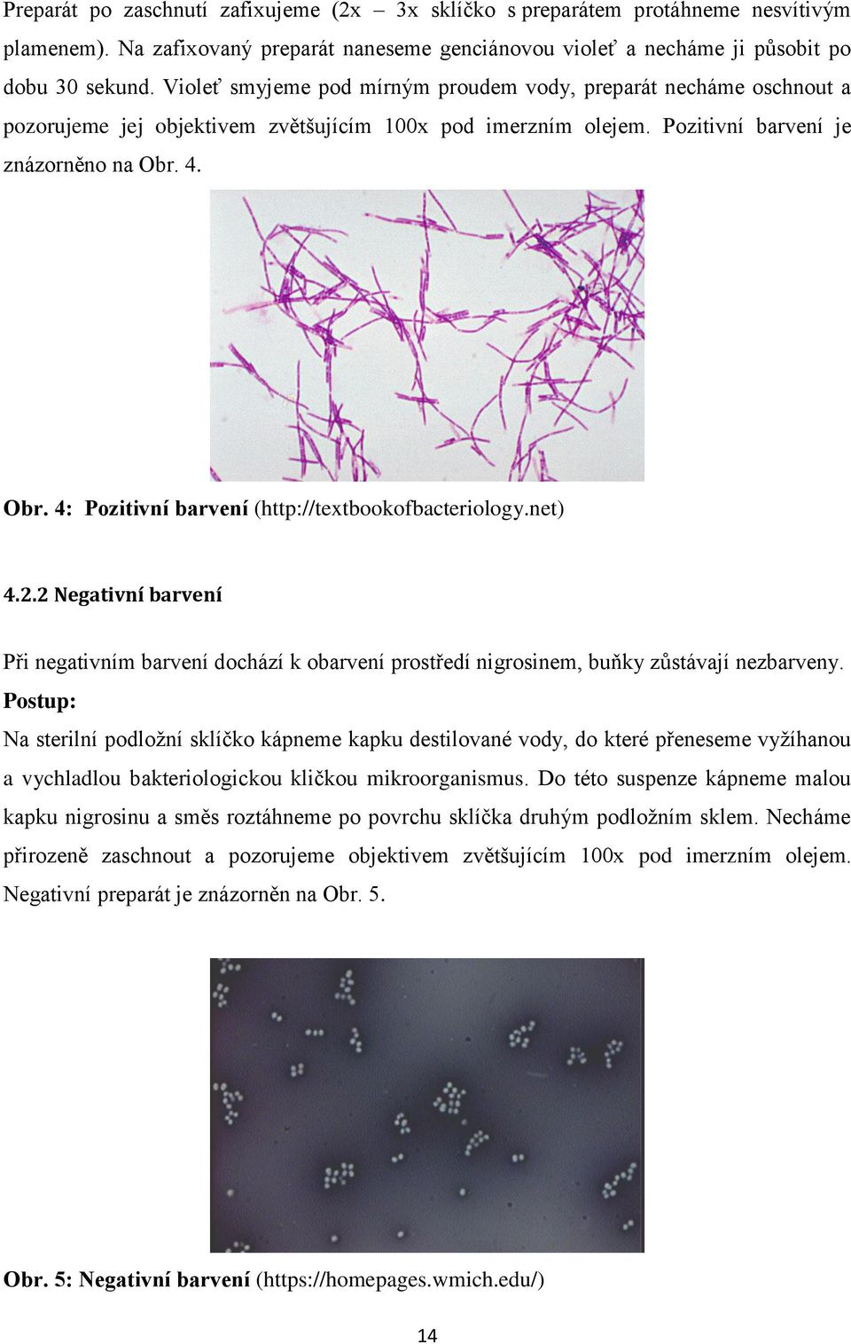 4. Obr. 4: Pozitivní barvení (http://textbookofbacteriology.net) 4.2.2 Negativní barvení Při negativním barvení dochází k obarvení prostředí nigrosinem, buňky zůstávají nezbarveny.