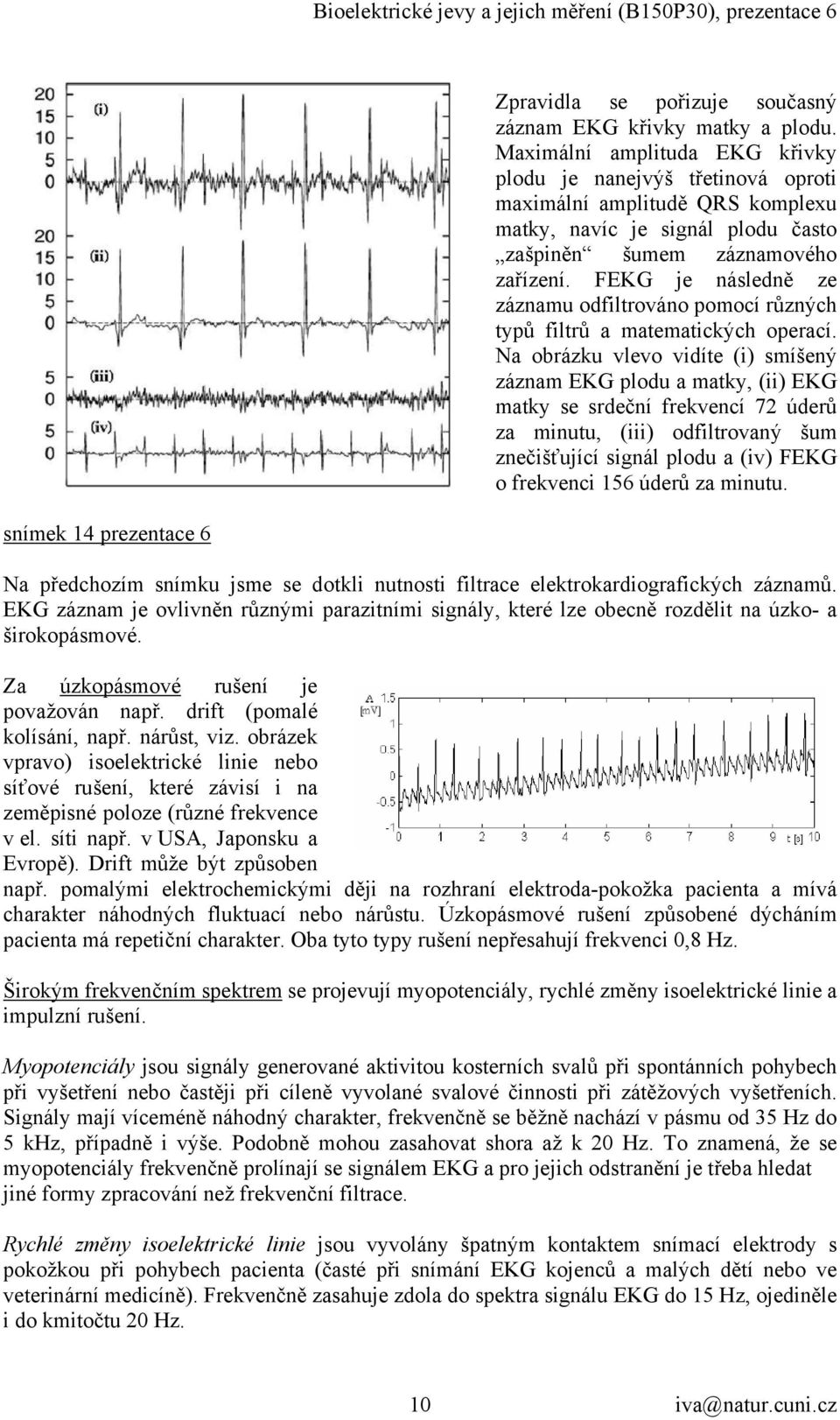 FEKG je následně ze záznamu odfiltrováno pomocí různých typů filtrů a matematických operací.