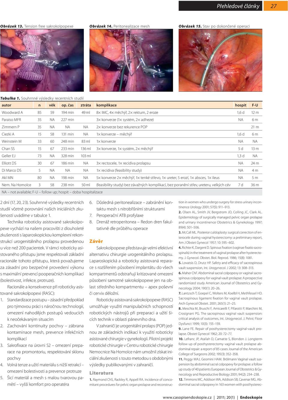 konverze bez rekurence POP 21 m Ciezki A 15 58 131 min NA 1 konverze měchýř 1,6 d 6 m Weinstein M 33 60 248 min 83 ml 1 konverze NA NA Chan SS 15 67 233 min 136 ml 3 konverze, 1 systém, 2 měchýř 5 d