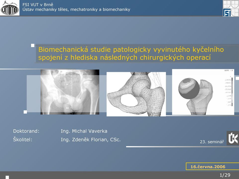 hlediska následných chirurgických operací Doktorand: Ing.