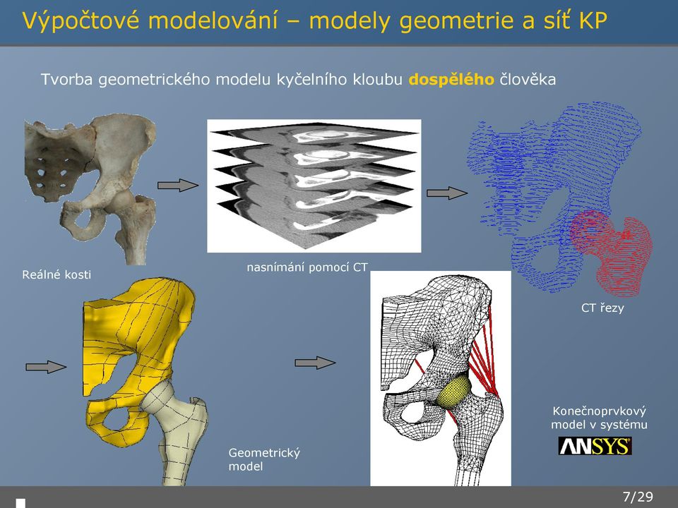 dospělého člověka Reálné kosti nasnímání pomocí CT