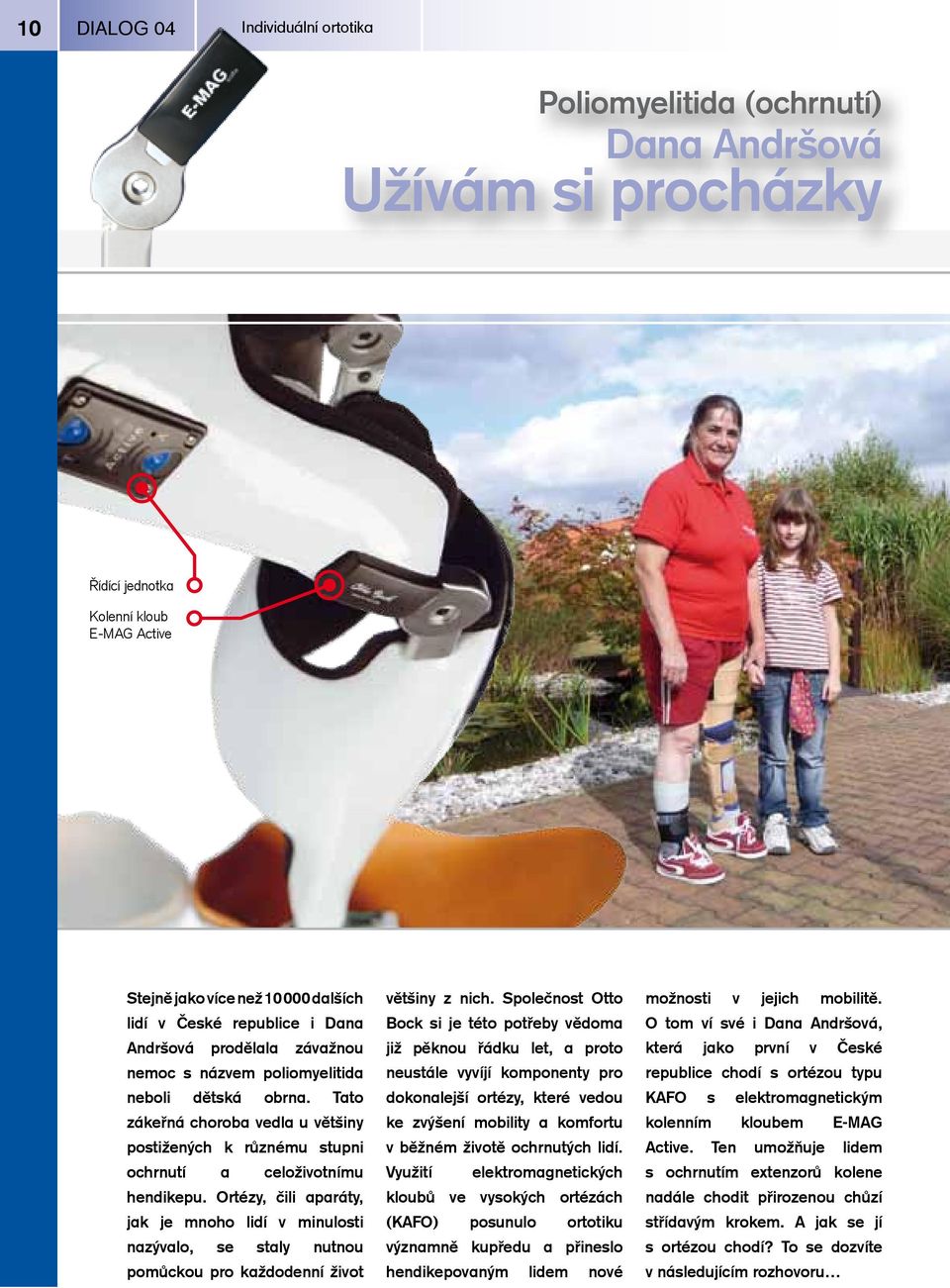 Ortézy, čili aparáty, jak je mnoho lidí v minulosti nazývalo, se staly nutnou pomůckou pro každodenní život většiny z nich.