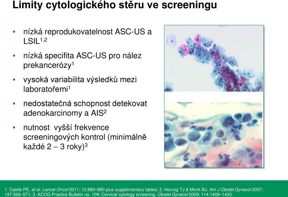 screeningových kontrol (minimálně každé 2-3 roky) 3 1. Castle PE, et al. Lancet Oncol 2011; 12:880 890 plus supplementary tables; 2.